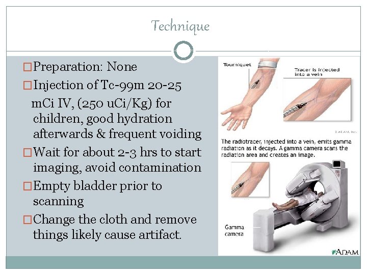 Technique �Preparation: None �Injection of Tc-99 m 20 -25 m. Ci IV, (250 u.