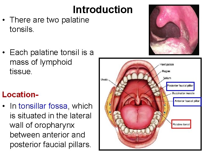 Introduction • There are two palatine tonsils. • Each palatine tonsil is a mass