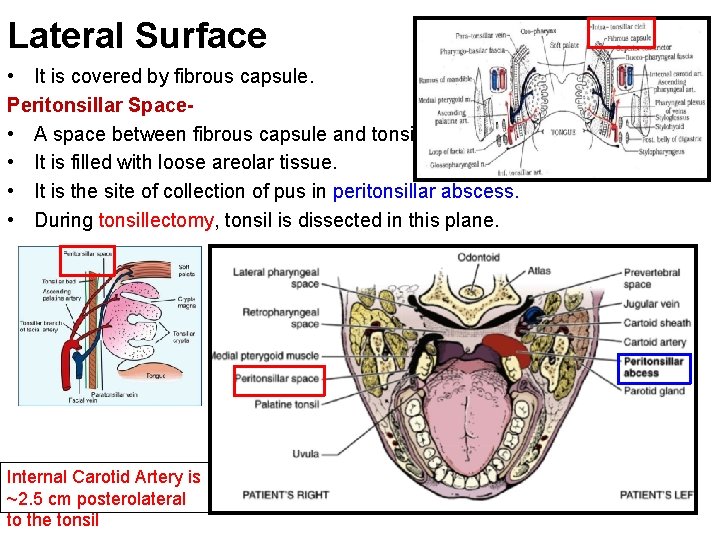 Lateral Surface • It is covered by fibrous capsule. Peritonsillar Space • A space