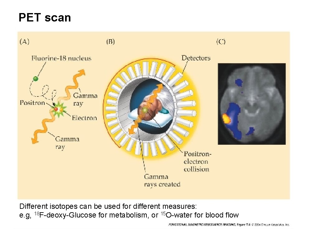 PET scan Different isotopes can be used for different measures: e. g, 18 F-deoxy-Glucose
