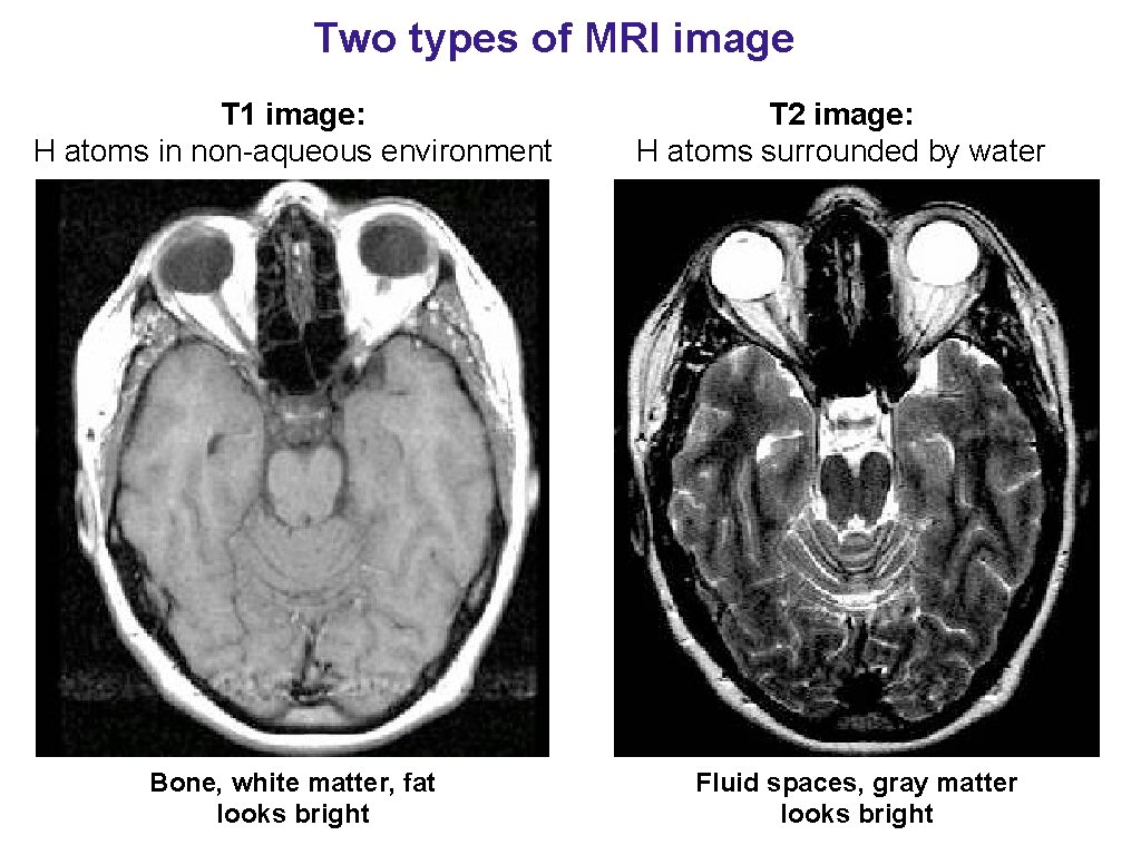 Two types of MRI image T 1 image: H atoms in non-aqueous environment Bone,