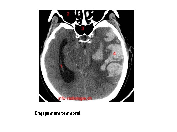 Engagement temporal 