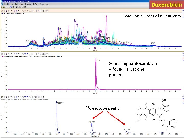 Doxorubicin Total ion current of all patients Searching for doxorubicin – found in just