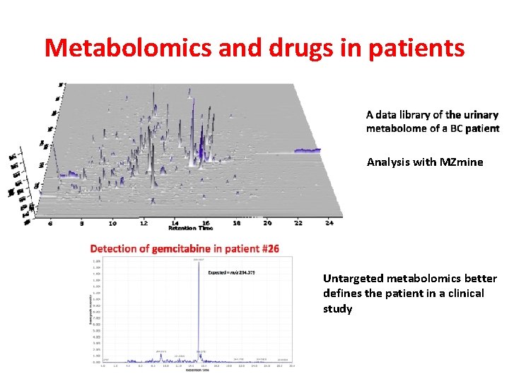 Metabolomics and drugs in patients Analysis with MZmine Untargeted metabolomics better defines the patient