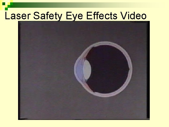 Laser Safety Eye Effects Video Loading Video Presentation………… 
