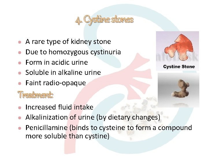 4. Cystine stones A rare type of kidney stone Due to homozygous cystinuria Form