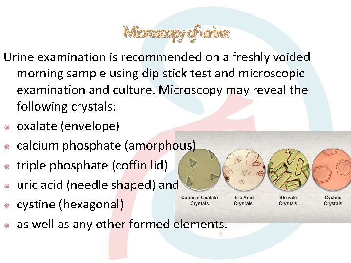 Microscopy of urine Urine examination is recommended on a freshly voided morning sample using