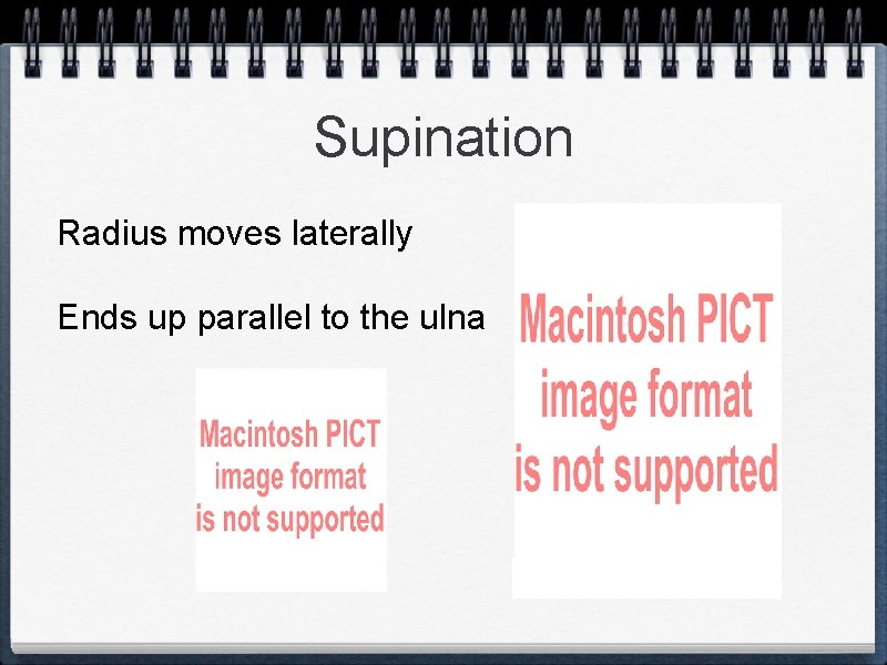 Supination Radius moves laterally Ends up parallel to the ulna 