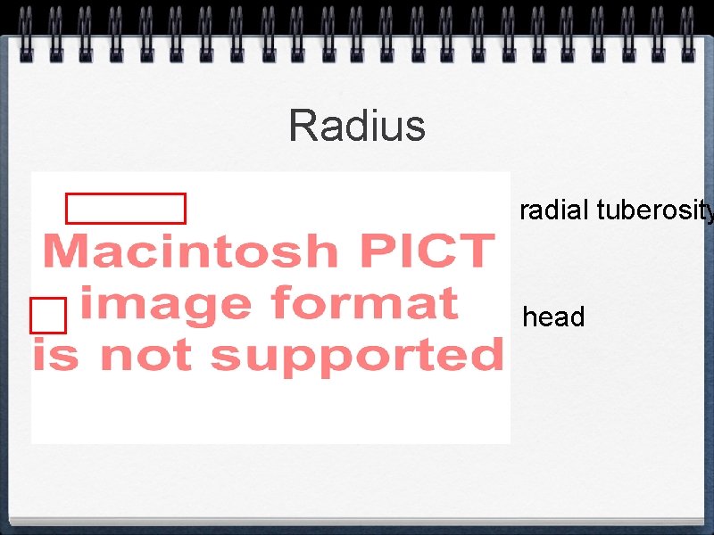 Radius radial tuberosity head 