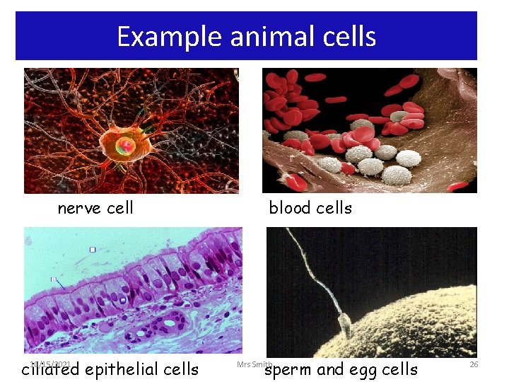 Example animal cells nerve cell 10/15/2021 ciliated epithelial cells blood cells sperm and egg