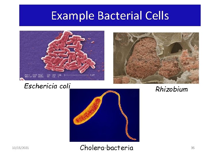 Example Bacterial Cells Eschericia coli 10/15/2021 Rhizobium Mrs Smith Cholera bacteria 35 