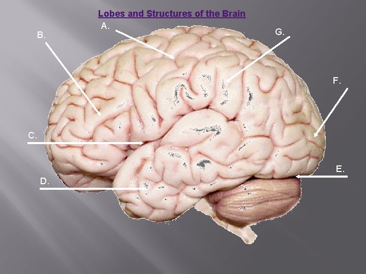 B. Lobes and Structures of the Brain A. G. F. C. E. D. 