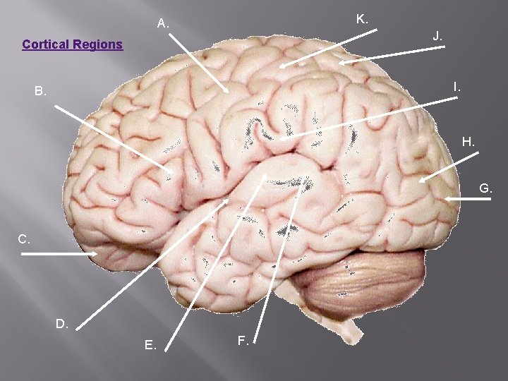 K. A. J. Cortical Regions I. B. H. G. C. D. E. F. 