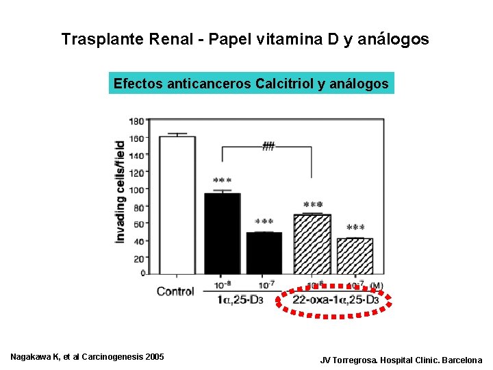 Trasplante Renal - Papel vitamina D y análogos Efectos anticanceros Calcitriol y análogos Nagakawa