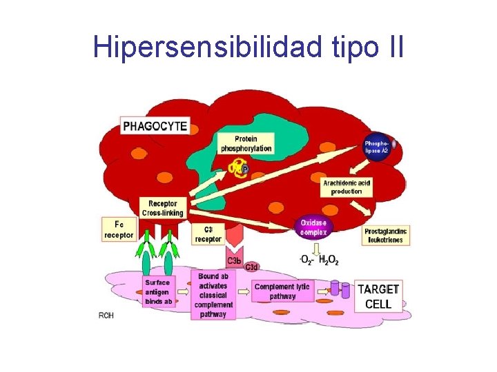 Hipersensibilidad tipo II 