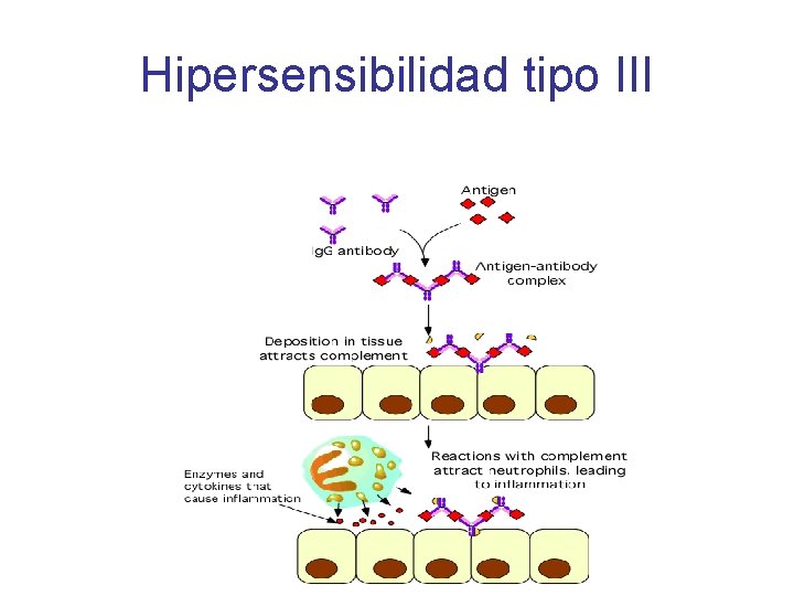 Hipersensibilidad tipo III 