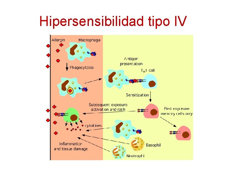 Hipersensibilidad tipo IV 