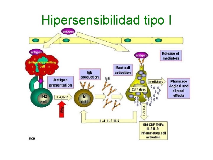 Hipersensibilidad tipo I 