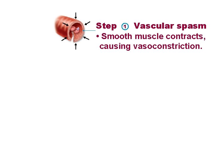 Step 1 Vascular spasm • Smooth muscle contracts, causing vasoconstriction. 