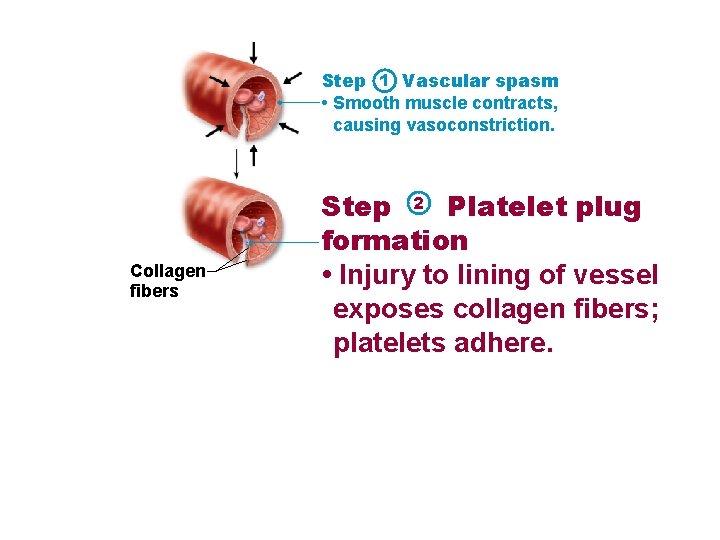 Step 1 Vascular spasm • Smooth muscle contracts, causing vasoconstriction. Collagen fibers Step 2