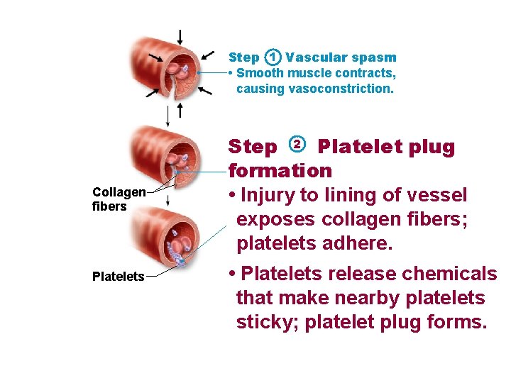 Step 1 Vascular spasm • Smooth muscle contracts, causing vasoconstriction. Collagen fibers Platelets Step