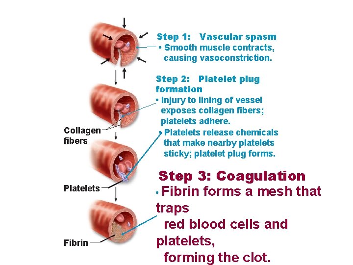 Step 1: Vascular spasm • Smooth muscle contracts, causing vasoconstriction. Collagen fibers Platelets Fibrin