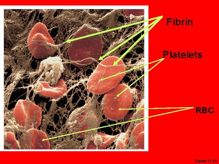 Fibrin Platelets RBC Figure 17. 15 