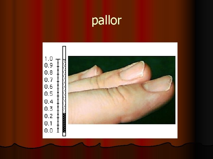 pallor 