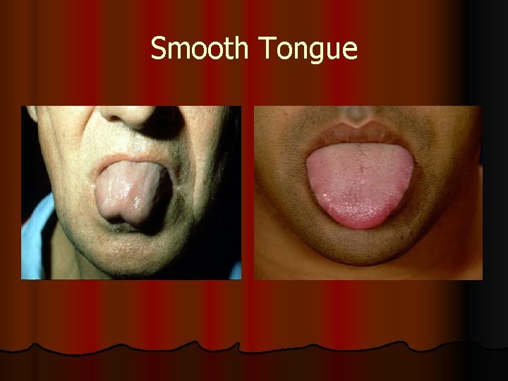 Smooth Tongue 
