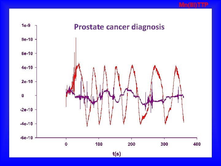 Mn(III)TTP Prostate cancer diagnosis 