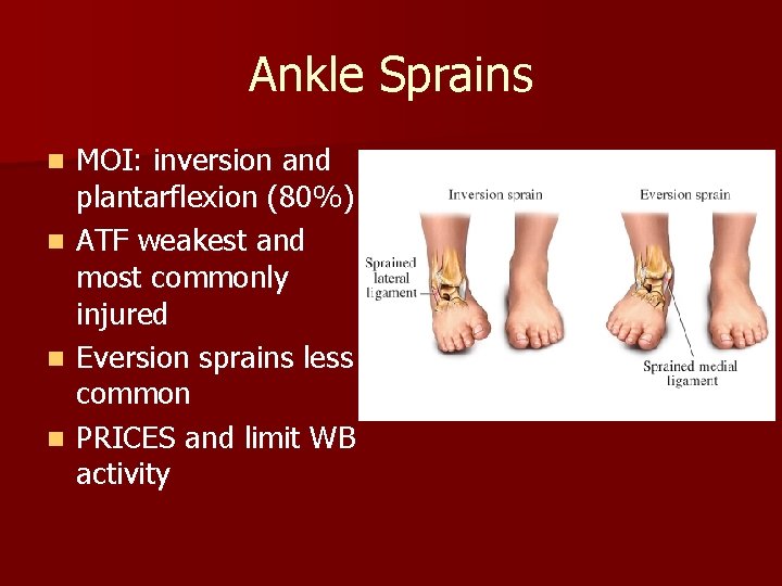 Ankle Sprains n n MOI: inversion and plantarflexion (80%) ATF weakest and most commonly