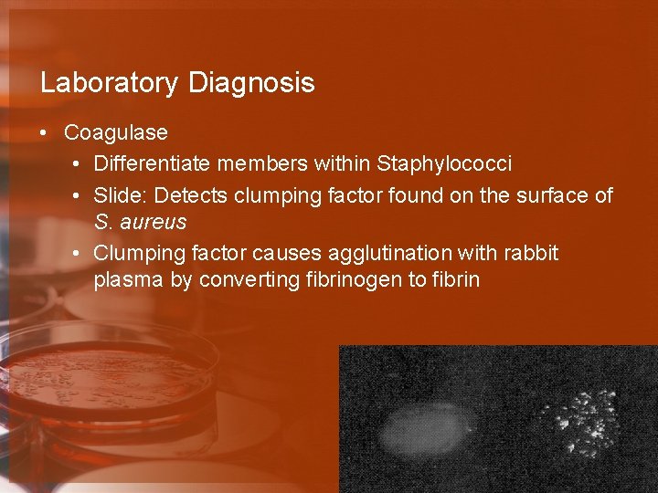 Laboratory Diagnosis • Coagulase • Differentiate members within Staphylococci • Slide: Detects clumping factor