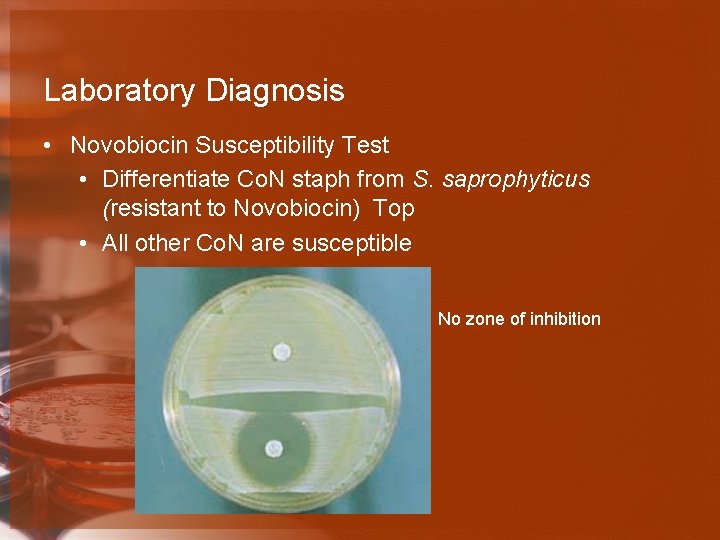 Laboratory Diagnosis • Novobiocin Susceptibility Test • Differentiate Co. N staph from S. saprophyticus