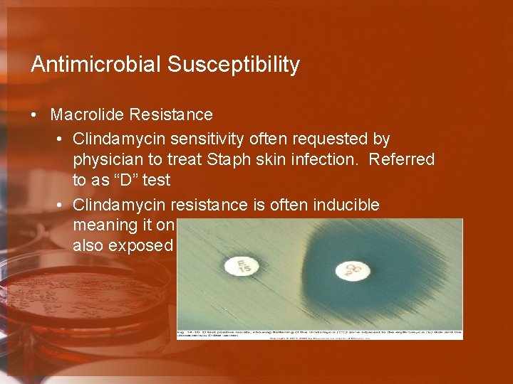 Antimicrobial Susceptibility • Macrolide Resistance • Clindamycin sensitivity often requested by physician to treat