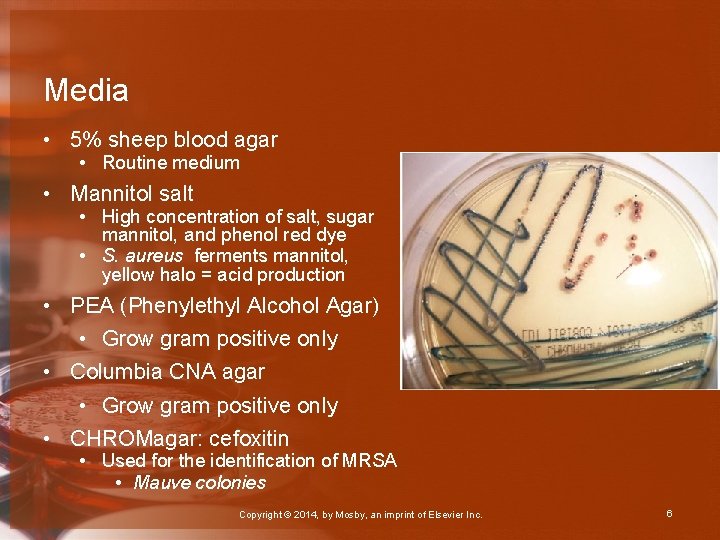 Media • 5% sheep blood agar • Routine medium • Mannitol salt • High