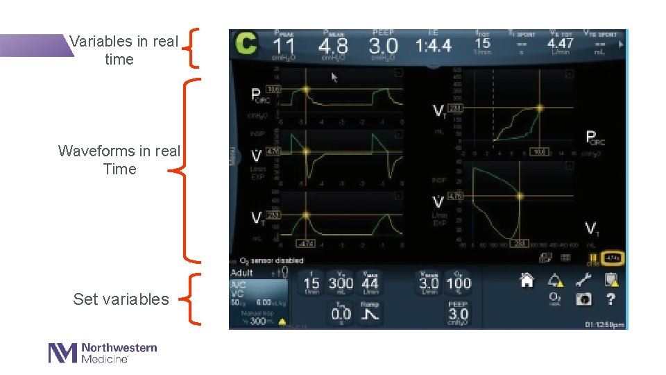 Variables in real time Waveforms in real Time Set variables 