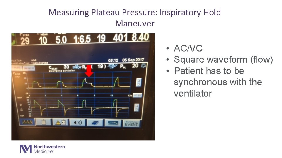 Measuring Plateau Pressure: Inspiratory Hold Maneuver • AC/VC • Square waveform (flow) • Patient