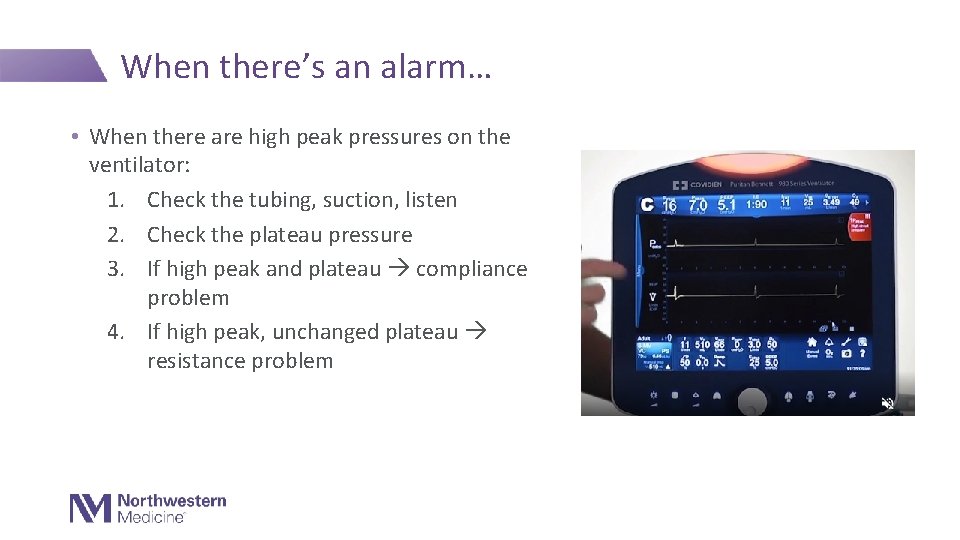 When there’s an alarm… • When there are high peak pressures on the ventilator: