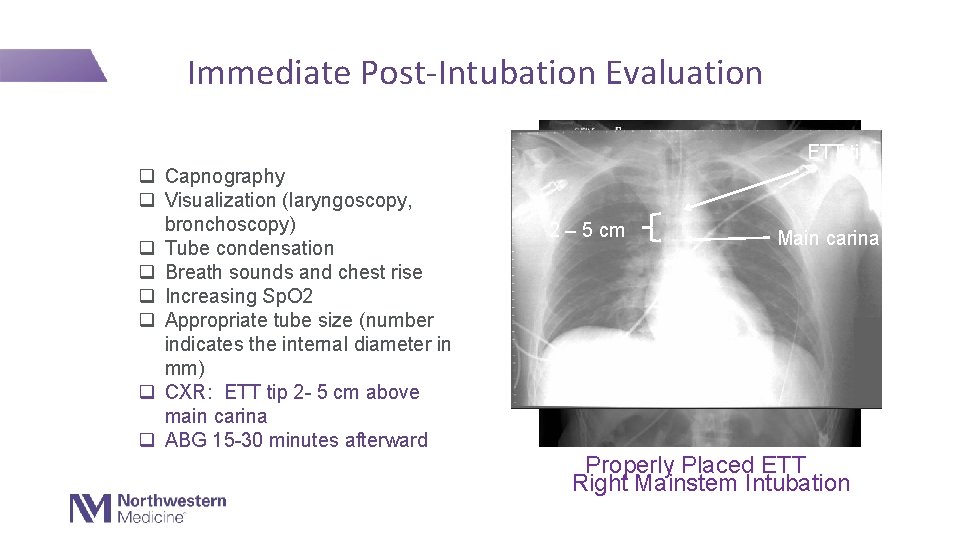 Immediate Post-Intubation Evaluation ETT tip q Capnography q Visualization (laryngoscopy, bronchoscopy) q Tube condensation