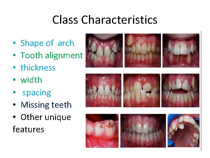 Class Characteristics • Shape of arch • Tooth alignment • thickness • width •