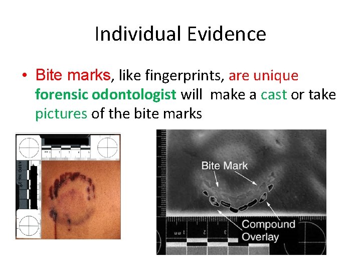 Individual Evidence • Bite marks, like fingerprints, are unique forensic odontologist will make a
