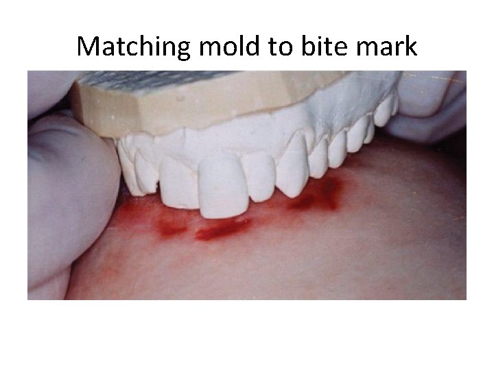 Matching mold to bite mark 