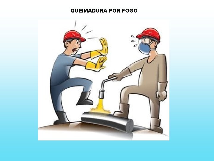 QUEIMADURA POR FOGO 