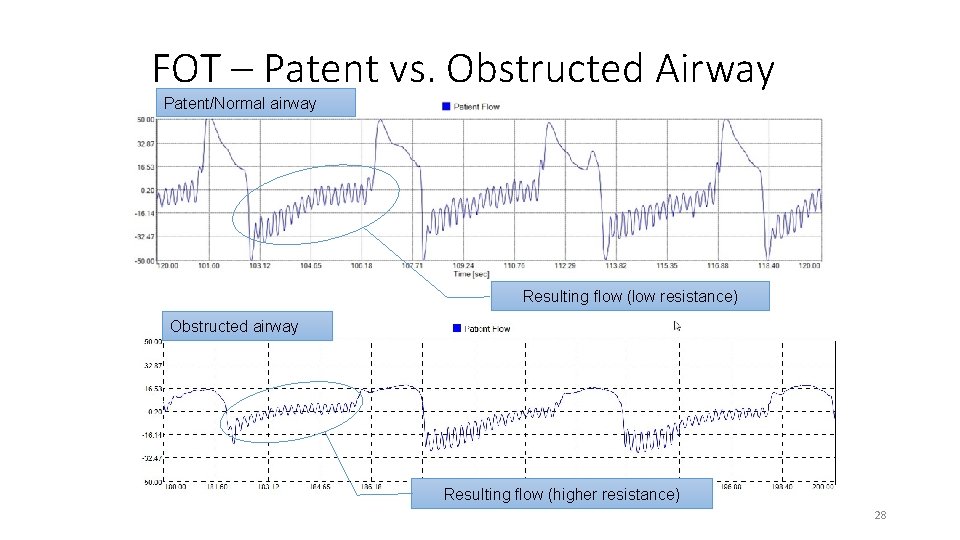 FOT – Patent vs. Obstructed Airway Patent/Normal airway Resulting flow (low resistance) Obstructed airway