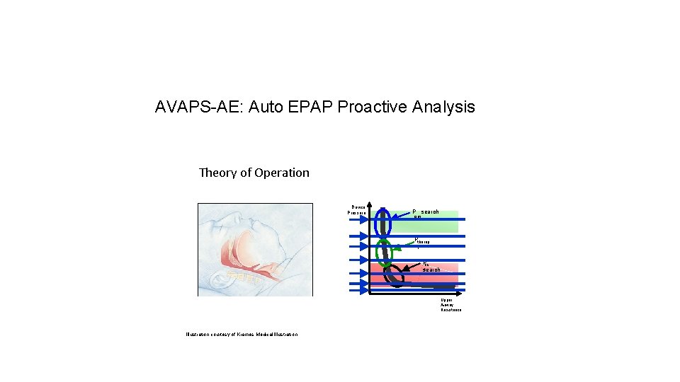 AVAPS-AE: Auto EPAP Proactive Analysis Theory of Operation Device Pressure P search opt Ptherap