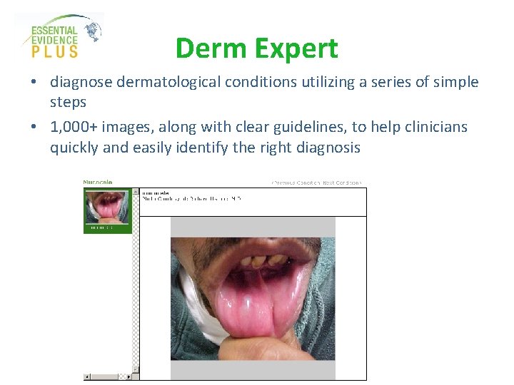 Derm Expert • diagnose dermatological conditions utilizing a series of simple steps • 1,