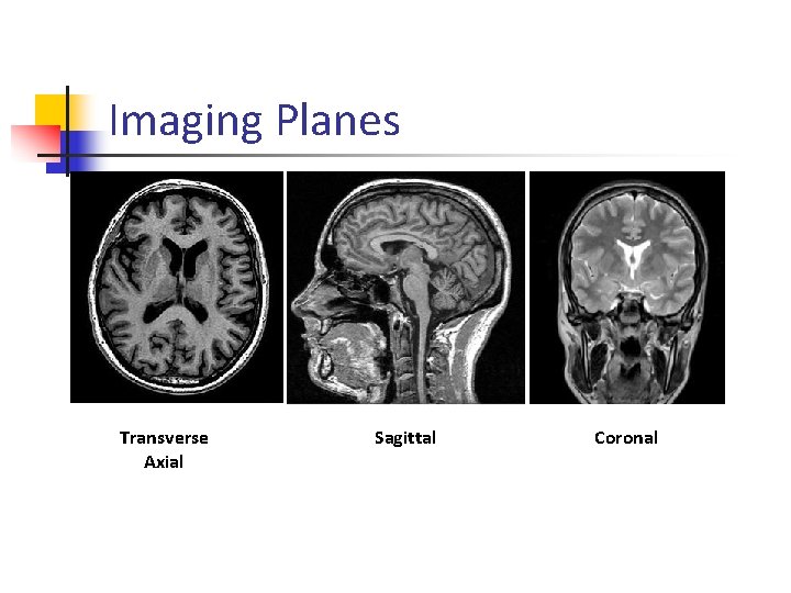 Imaging Planes Transverse Axial Sagittal Coronal 