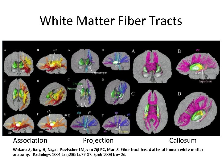 White Matter Fiber Tracts Association Projection Callosum Wakana S, Jiang H, Nagae-Poetscher LM, van