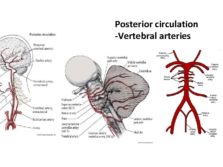 Posterior circulation -Vertebral arteries 