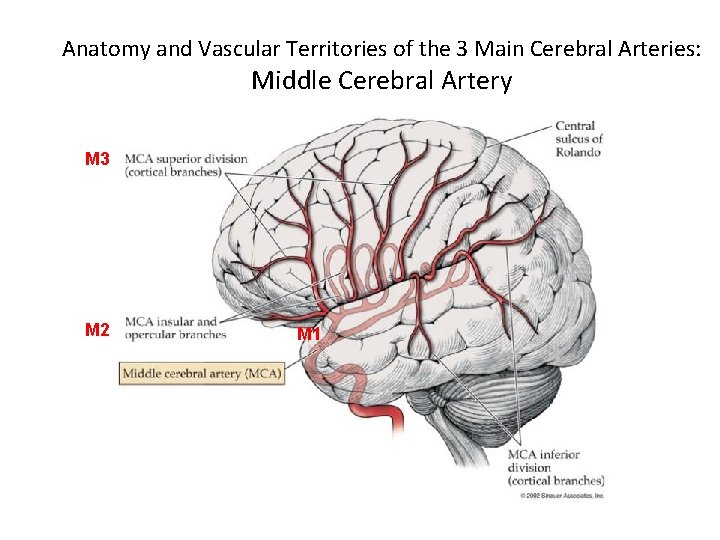 Anatomy and Vascular Territories of the 3 Main Cerebral Arteries: Middle Cerebral Artery M